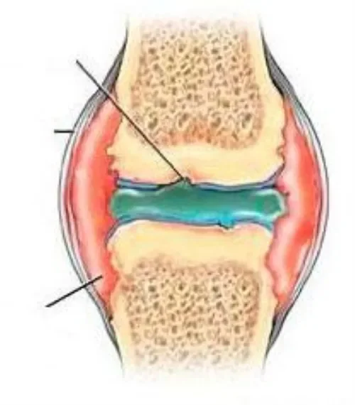 Flexosamine